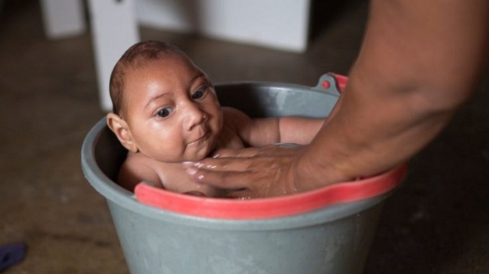 Story of Brazil`s Zika `bucket baby` - VIDEO